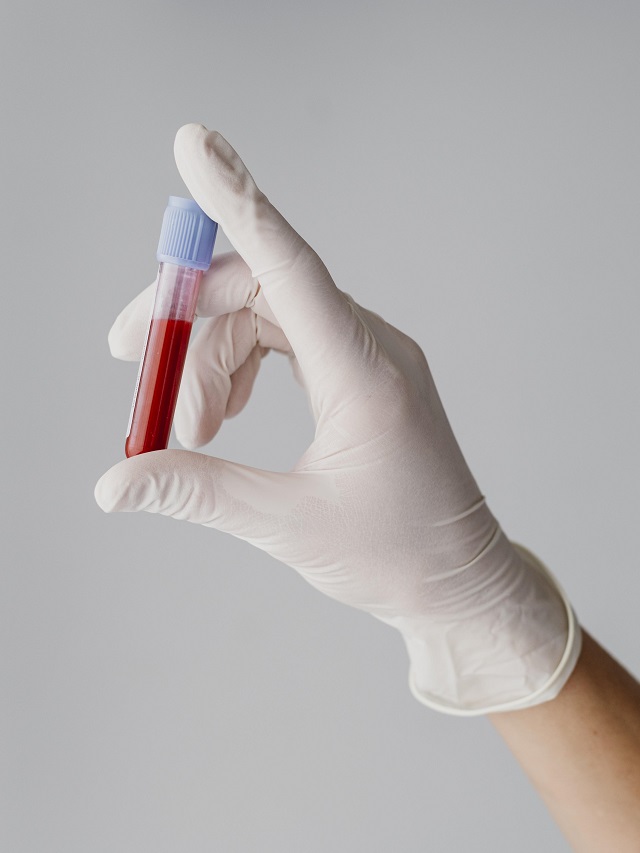 Exame de sangue pode detectar câncer colorretal com 83% de precisão