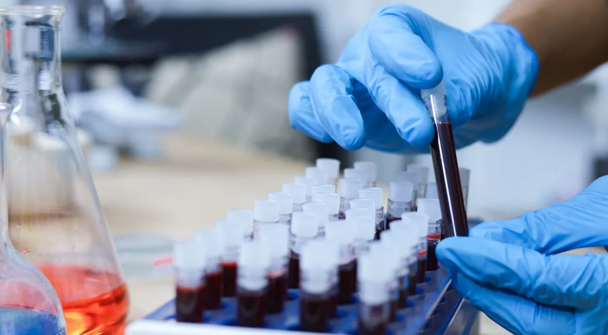 Exame de sangue com IA detecta precocemente nove tipos de câncer
