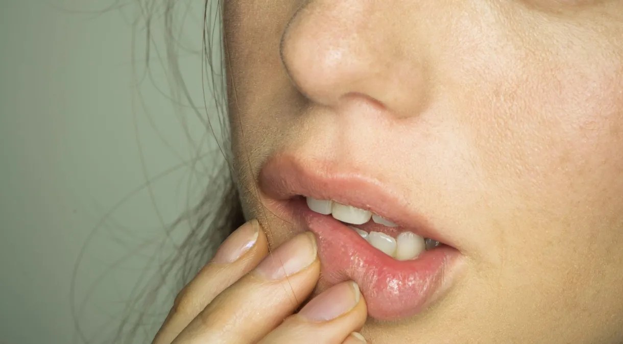 Lábios ressecados: veja causas, cuidados e dicas de hidratação