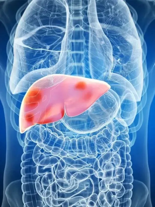 Hepatites virais: conheça os diferentes tipos e saiba como se proteger