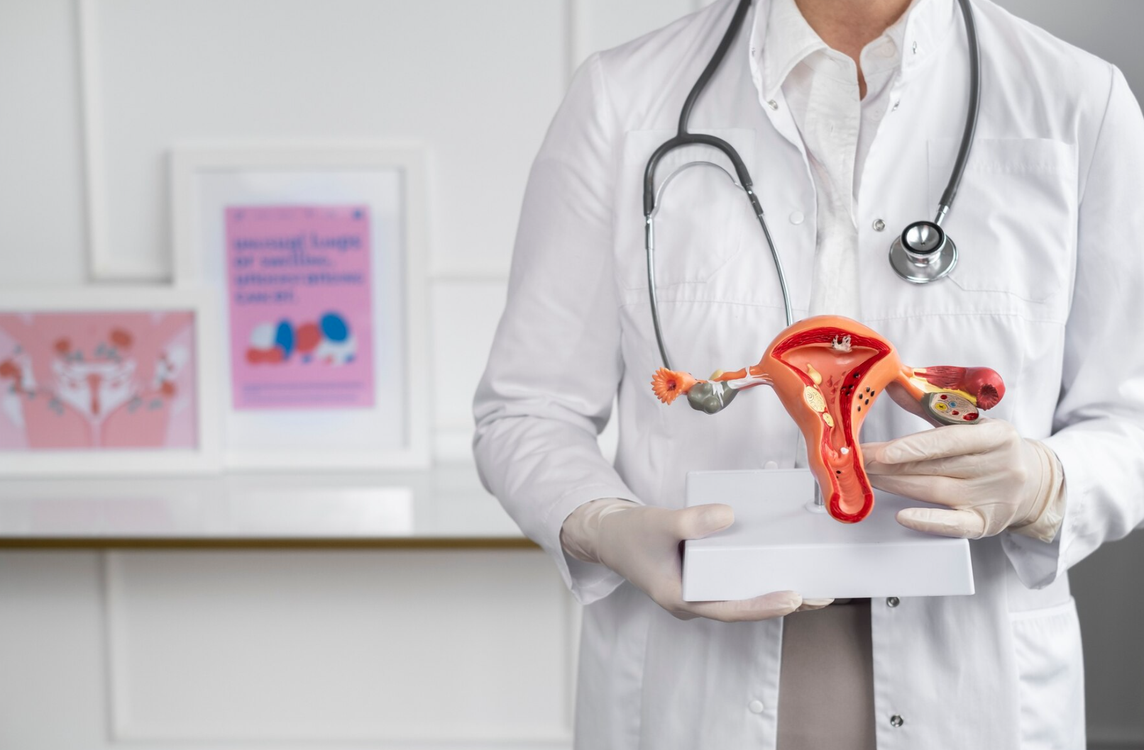 Mioma uterino: veja principais sintomas e como afeta qualidade de vida