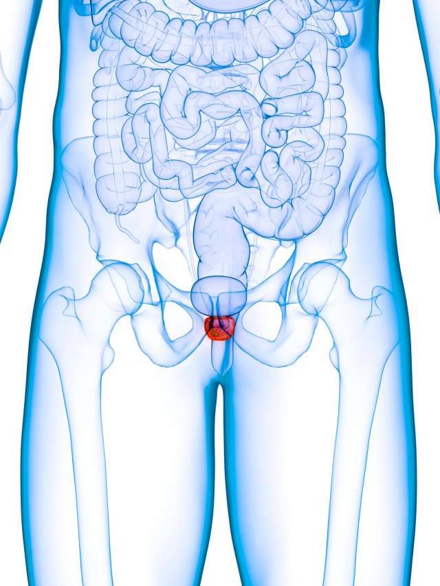 Câncer de próstata: veja mitos e verdades sobre a doença