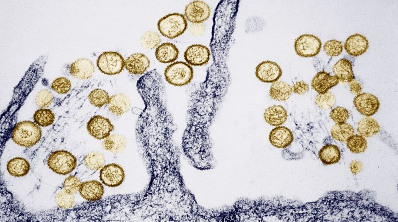 O que se sabe sobre a síndrome pulmonar por hantavírus