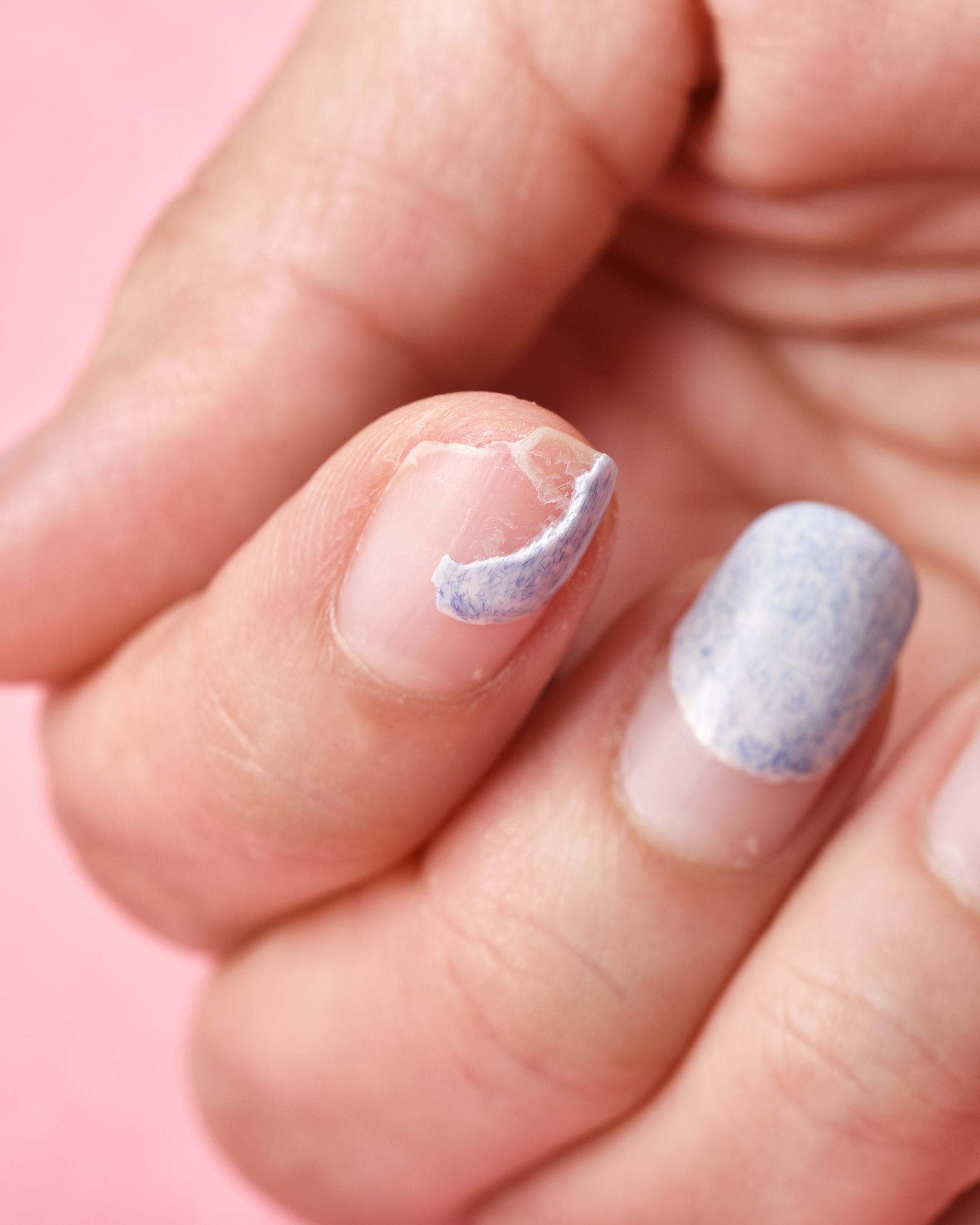 Unhas estriadas: o que pode ser e como trat&aacute;-las | CNN Brasil