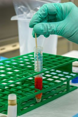 Cientistas editaram gene que pode reduzir colesterol alto