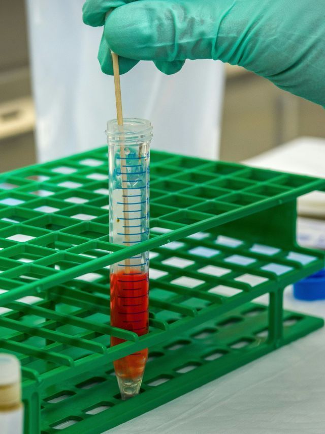 Cientistas editaram gene que pode reduzir colesterol alto