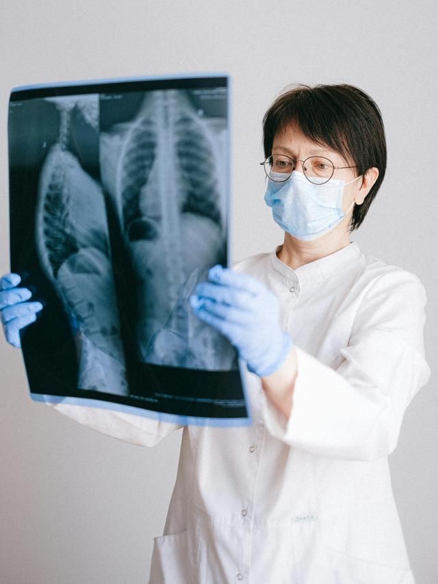 Casos de osteoporose devem disparar até 2050, inclusive no Brasil