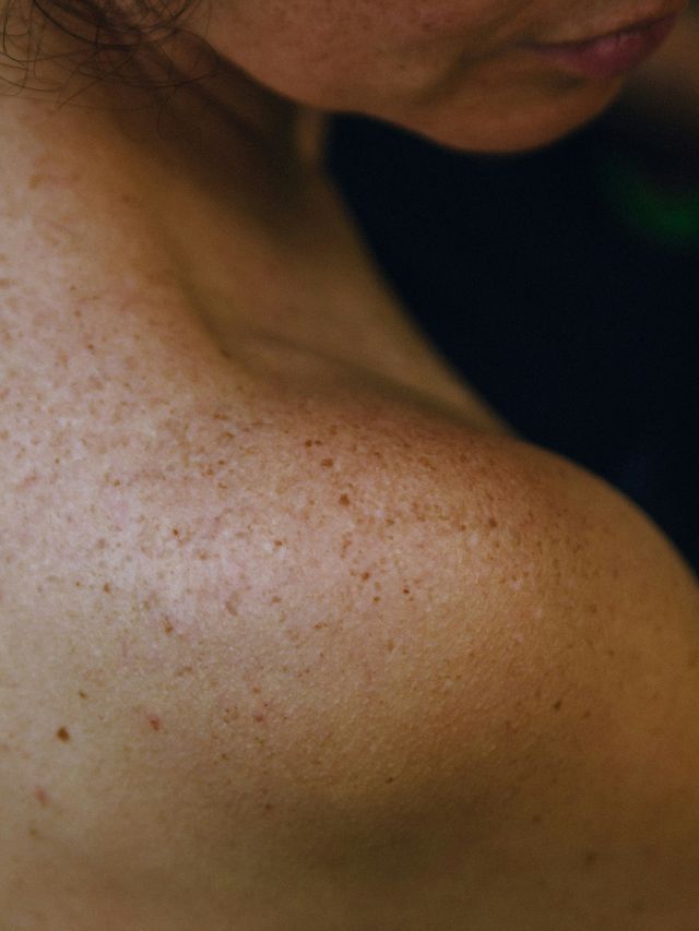 Uso de protetor solar reduz gastos em saúde pública