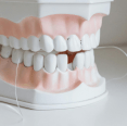 Uso regular de fio dental pode reduzir risco de AVC, mostra estudo