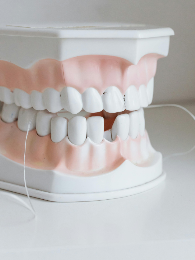 Uso regular de fio dental pode reduzir risco de AVC, mostra estudo