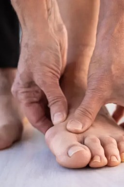 Joanete: por que surge, quando dói e como tratar para aliviar