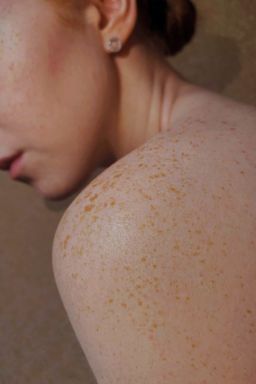 Vacina contra câncer de pele reduz em 49% risco de morte