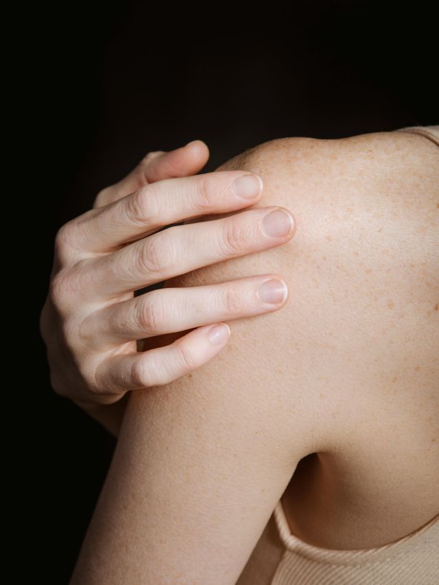 Dermatilomania: entenda o transtorno