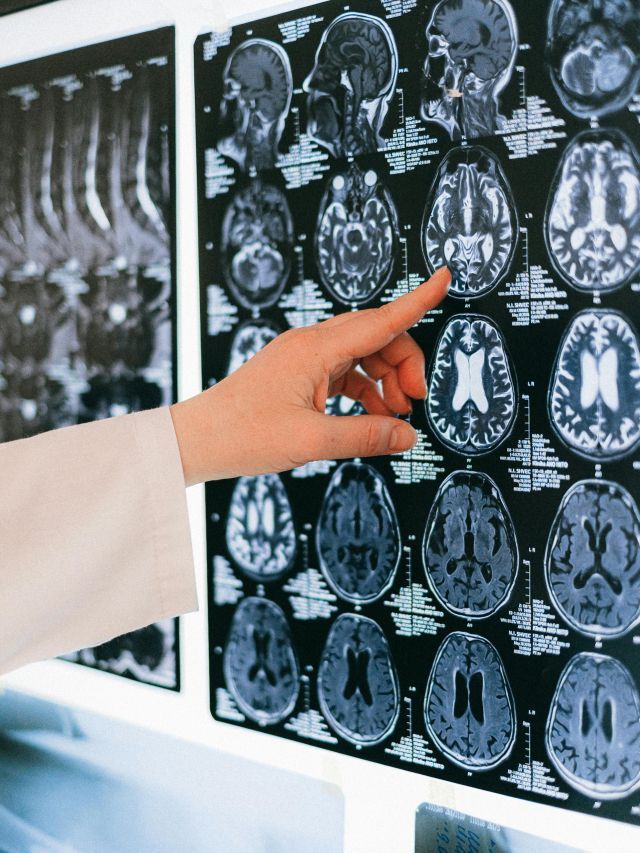 Como um marcapasso cerebral pode ajudar pacientes com Parkinson