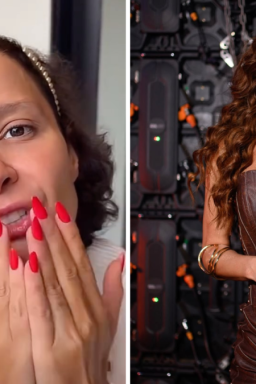 O que é alopecia androgenética, que afetou a cantora Maiara