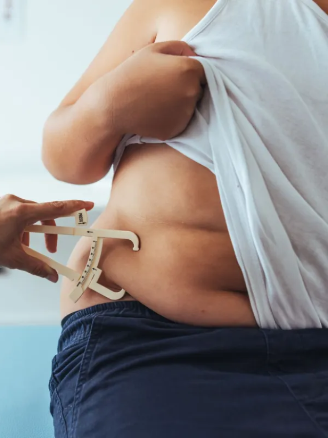 Obesidade ultrapassa desnutrição e atinge 1 em 10 crianças no mundo