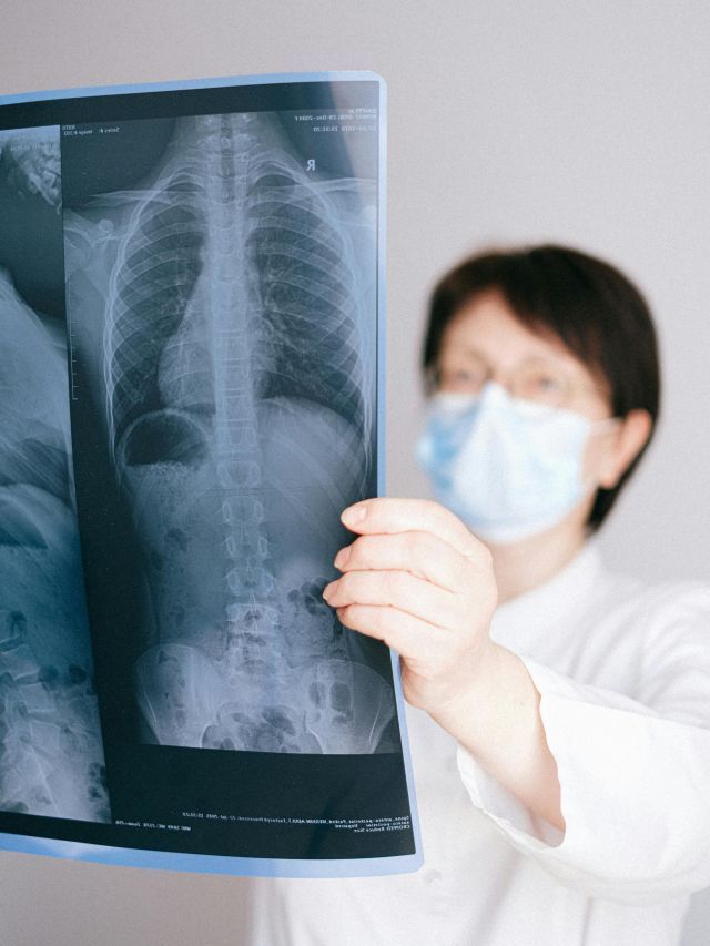 Tuberculose: novos antibióticos podem combater doença