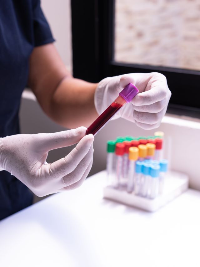 Estudo indica que jejum universal para exames de sangue é desnecessário